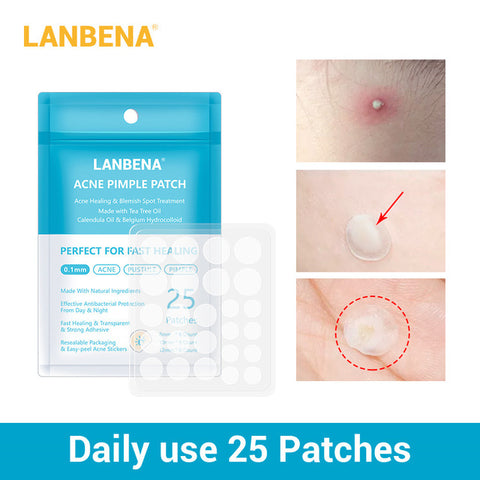 Acne Treatment Facial Mask