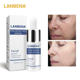 Acne Treatment Facial Mask