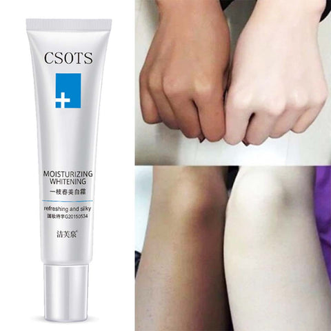 Whitening Cream Fade And Remove Freckless Whitening Miosturizing for Face Neck body Leg Skin Care Weaked Color Spot